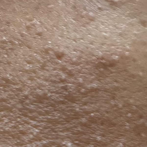 Vibha skin, hair and laser cli