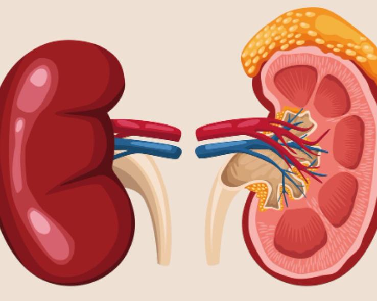 Kidney-related conditions can 