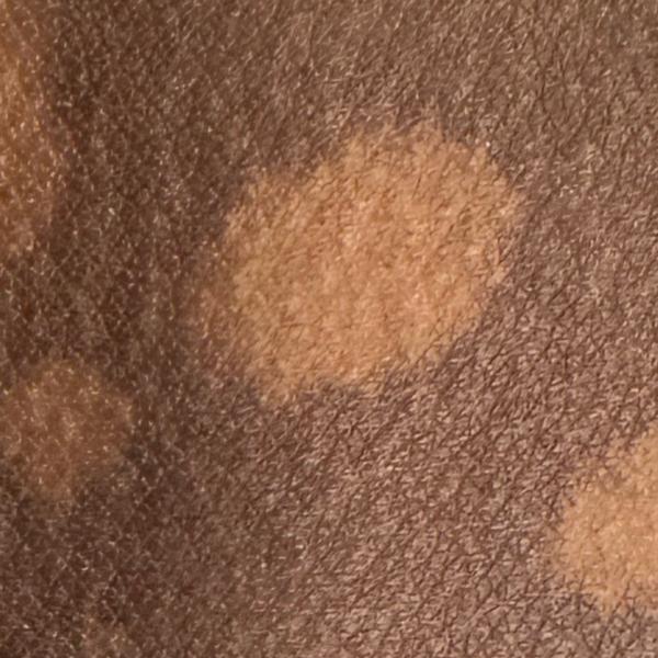 Dr.s.Valarmathi, the best derm