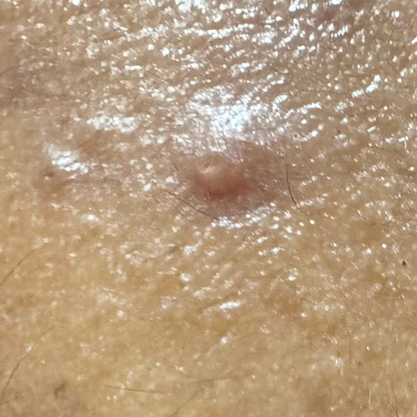 Vibha skin, hair and laser cli