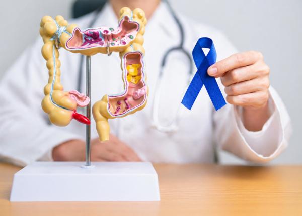 update image