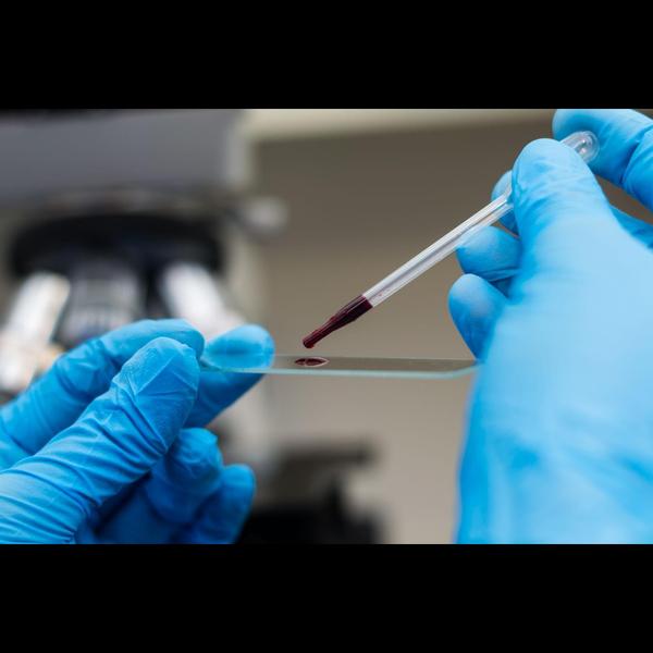 A blood smear examination help