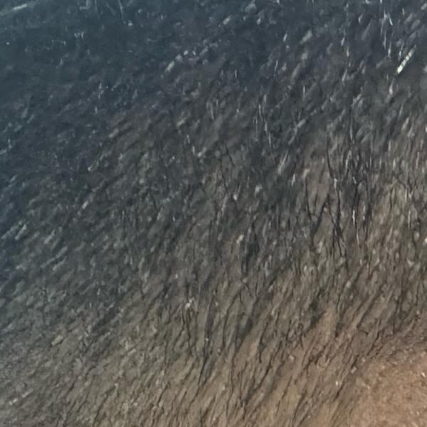 Dr.S.Valarmathi, a dermatologi