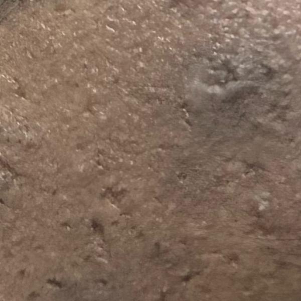 Vibha skin, hair and laser cli