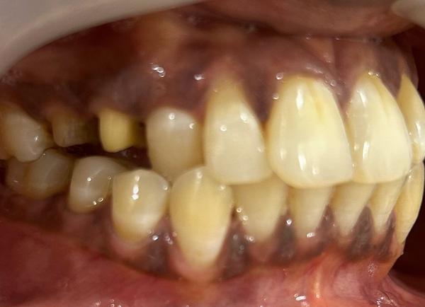 update image