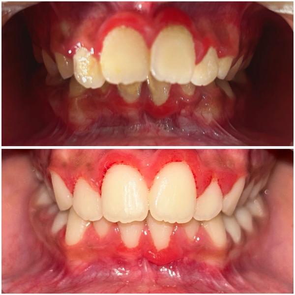 update image