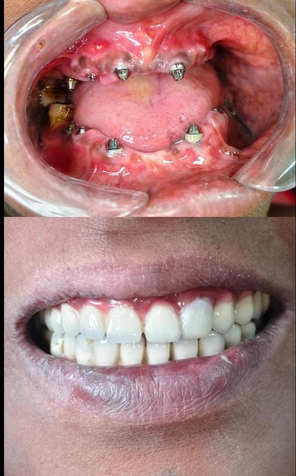 update image