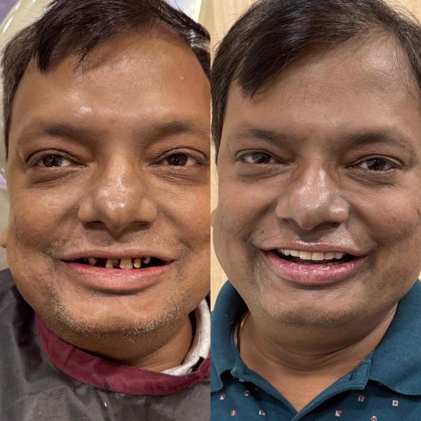 update image