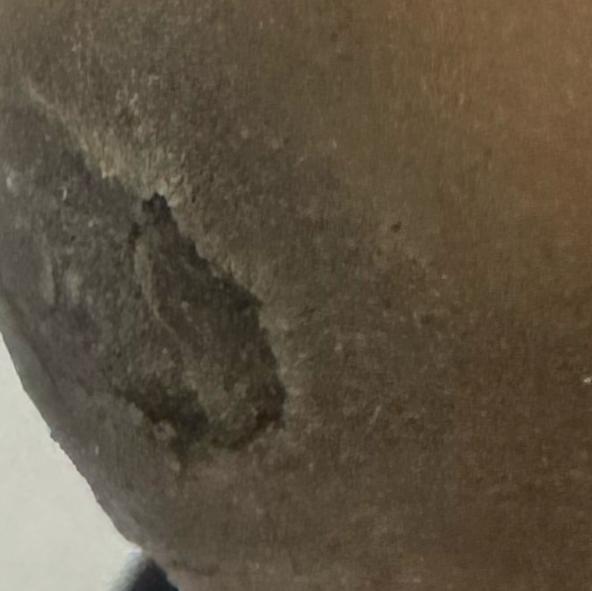 Vibha skin, hair and laser cli