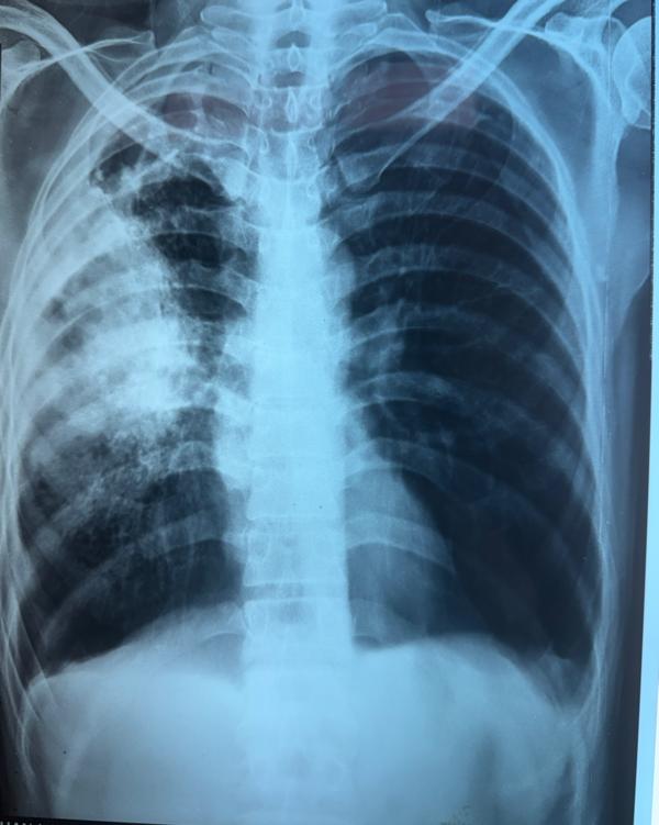 update image