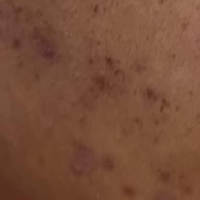 Vibha skin, hair and laser cli