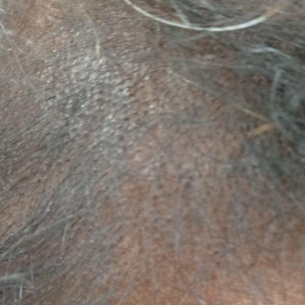 Dr.s.Valarmathi, a skin doctor