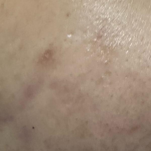 Vibha skin, hair and laser cli