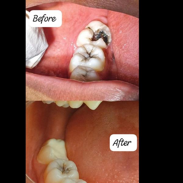 update image