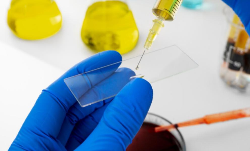 Cobalt Serum Test is a special