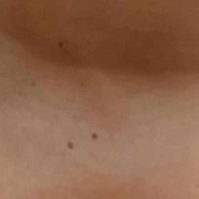 Vibha skin, hair and laser cli