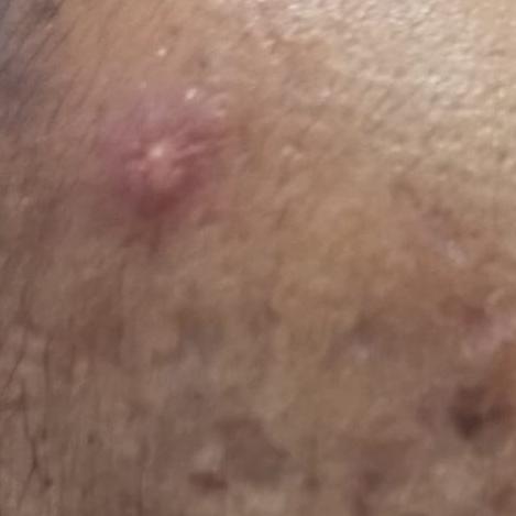 Vibha skin, hair and laser cli