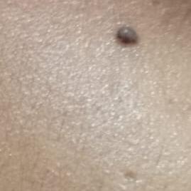 Vibha skin, hair and laser cli
