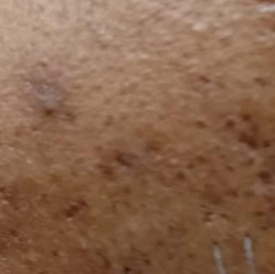 Vibha skin, hair and lase clin