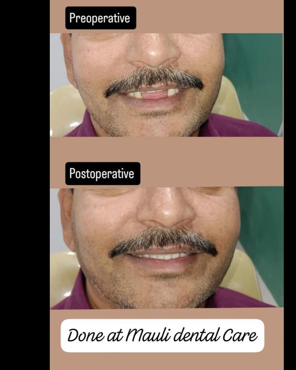 update image