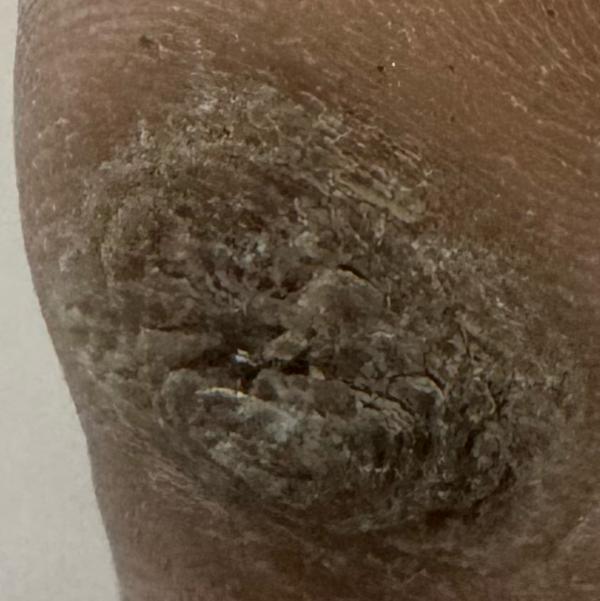Vibha skin, hair and laser cli