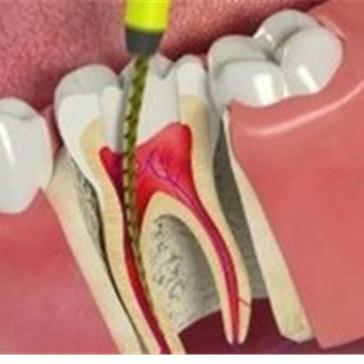 tooth angel dental clinic noid