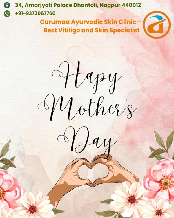 Vitiligo doesn’t change a mother’s beauty, it high