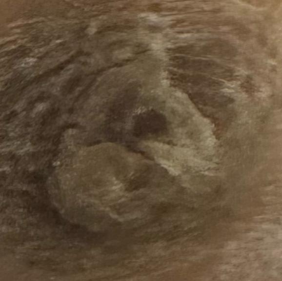 Vibha skin, hair and laser cli