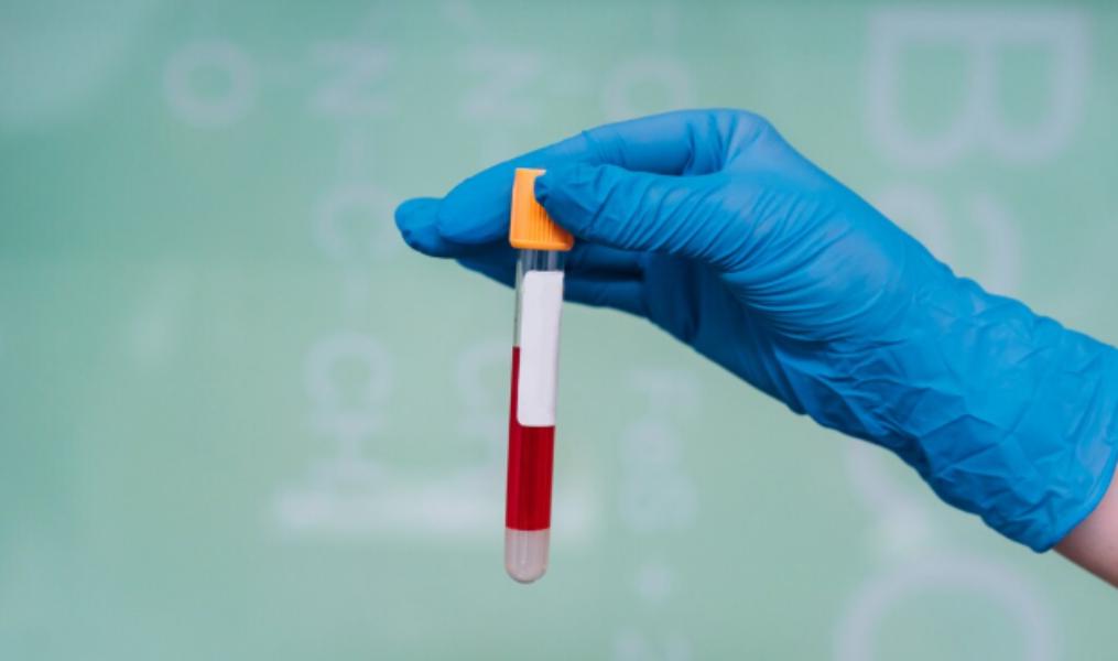 Dopamine Plasma Test is a spec