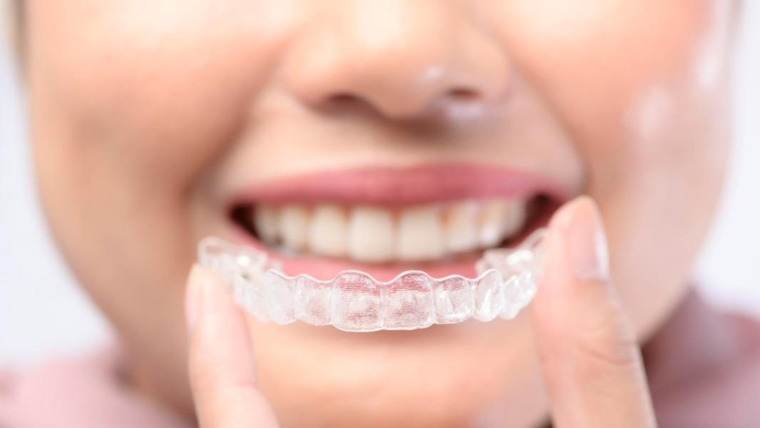 Invisalign has quietly become 