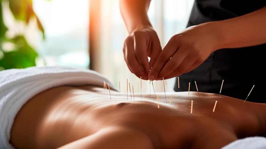 Acupuncture is increasingly be