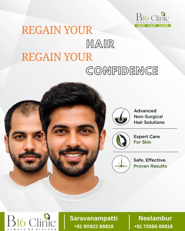 update image