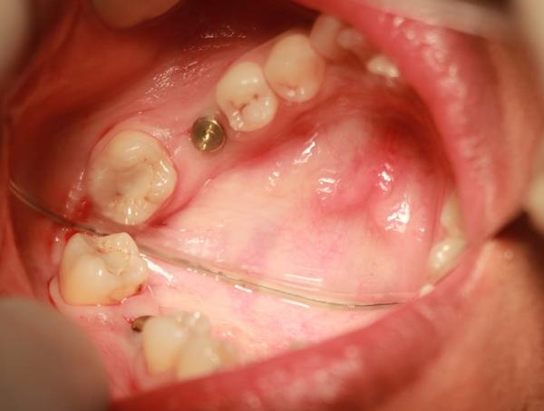 update image