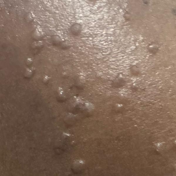 dermatology clinic in woraiyur
