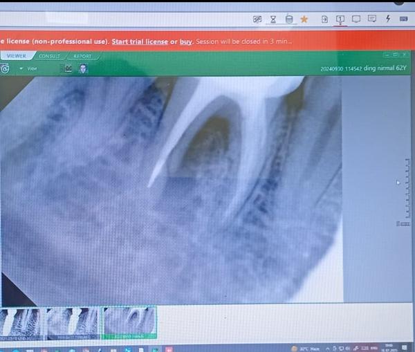 update image