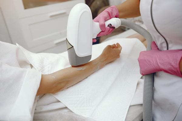 Laser hair removal is no longe
