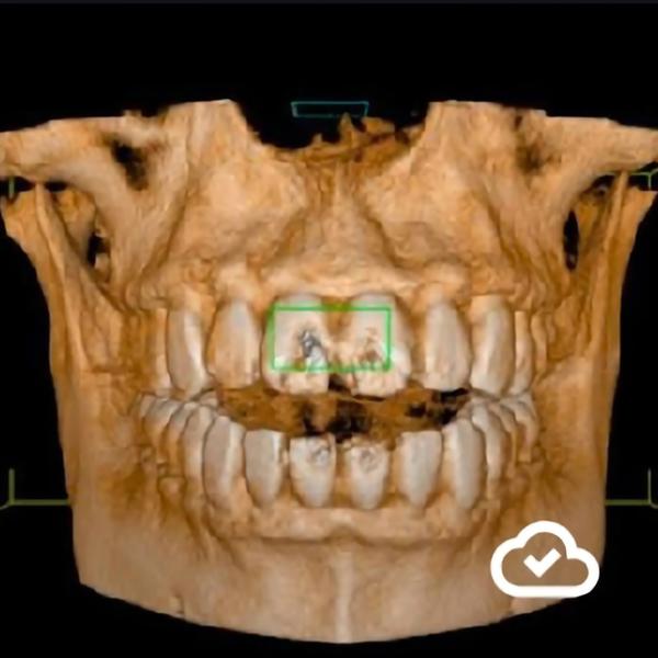 We offer: • Best Digital Denta