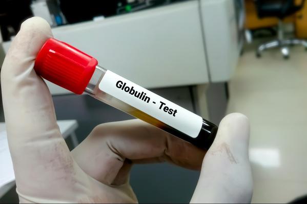 Globulin Test is an essential