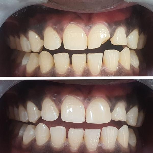 update image