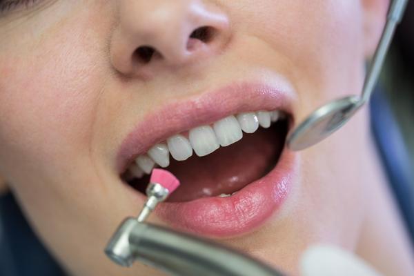 Teeth Whitening Treatment is o