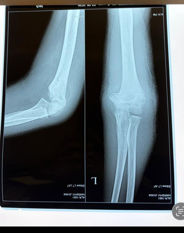 update image