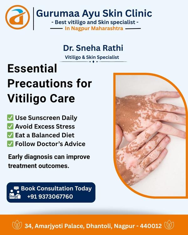 Essential Precautions for Vitiligo Care#gurumaaS