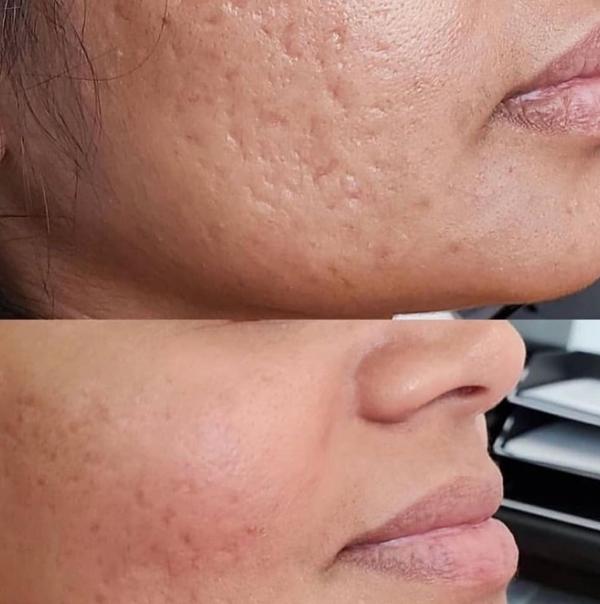 medically guided pigmentation