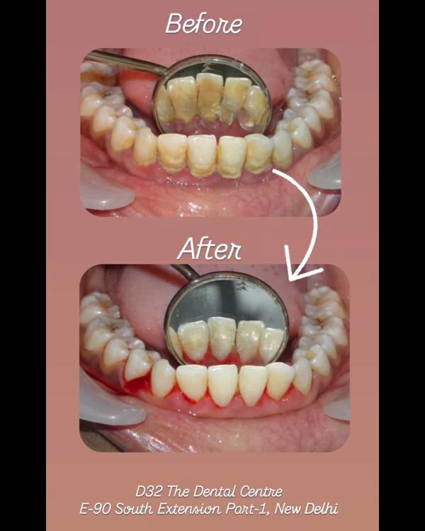 update image
