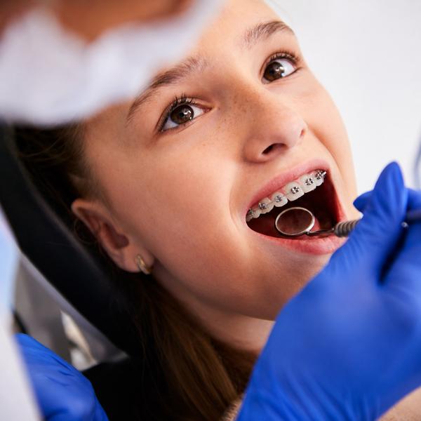 Best Aligners & Braces Treatme