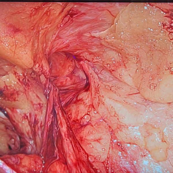update image