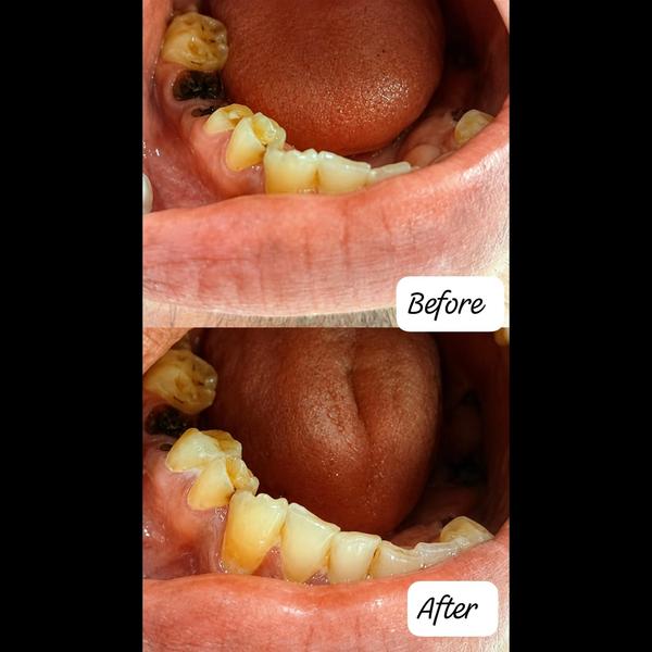 update image