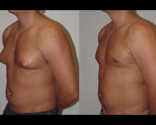 update image