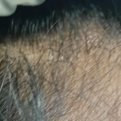Dr.s.Valarmathi, a skin doctor