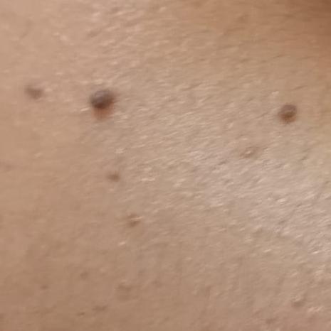 Vibha skin, hair and laser cli